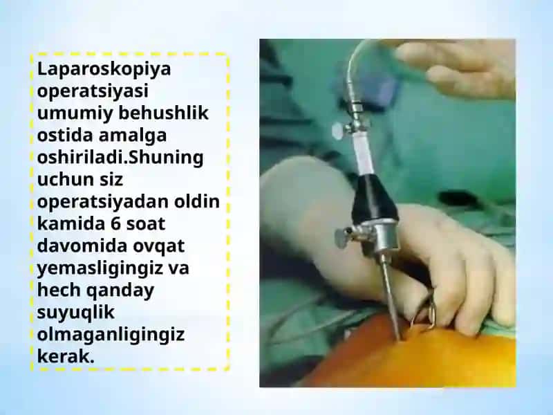 Laparoskopiyaning Tibbiyotda Qo’llanilishi 4