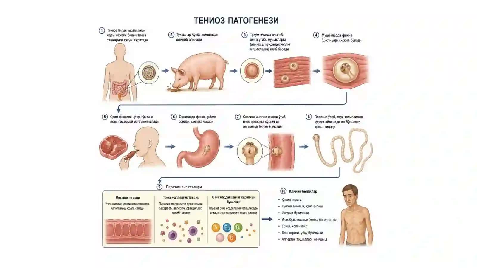 Тениоз 4