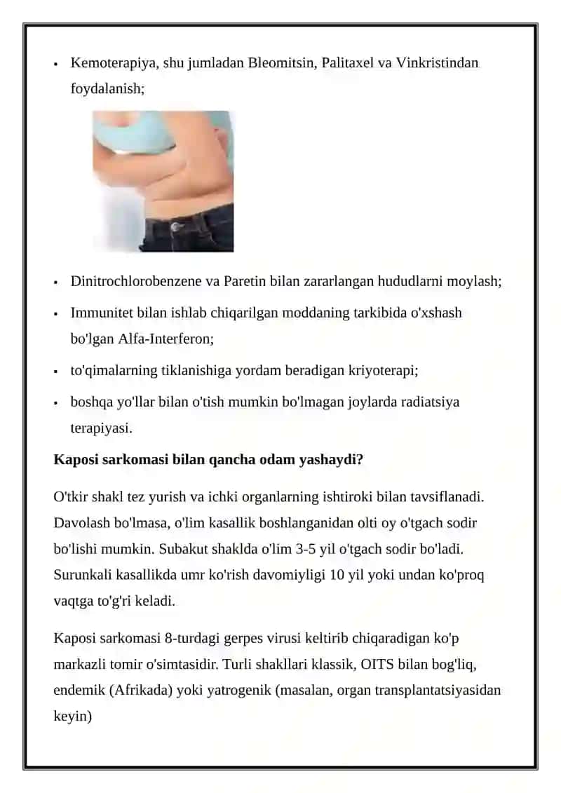 Kaposi sarkomasi 4