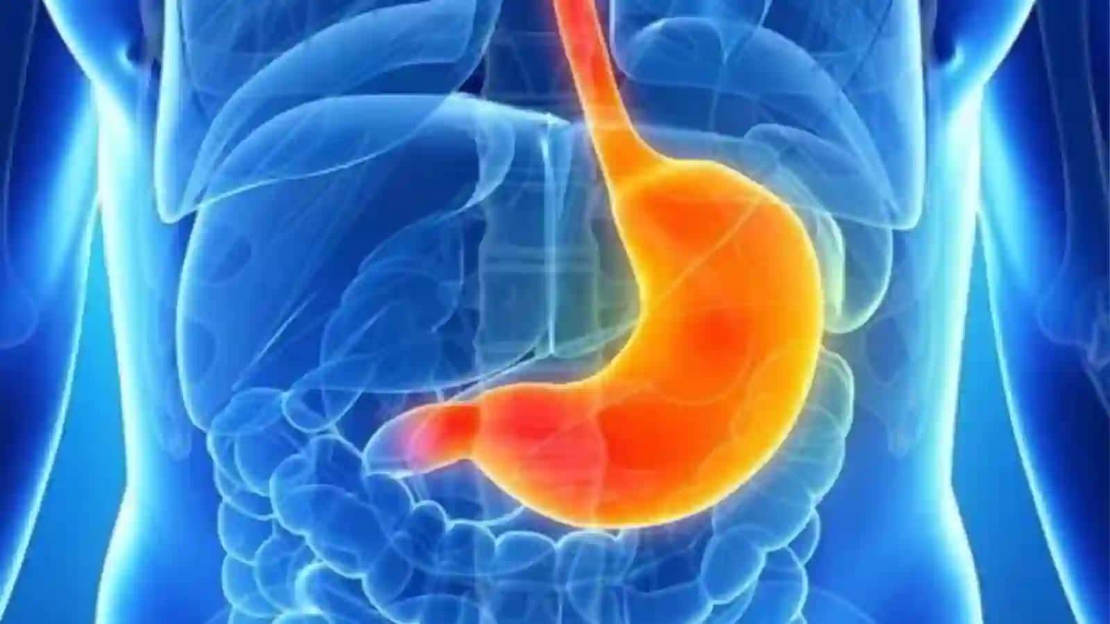 GASTRIT,OSHQOZON-ICHAK YARASI VA KOLIT KELIB CHIQISHIDA MIKRAOORGANIZIMLARNING AHAMIYATI,PATOGENIZI,LABORATORIYA TASHHISI. KAMPILOBAKTERIYALAR, KALIKOBAKTERIYALAR VA ULARNING AMALIYOTDAGI AHAMIYATi 4