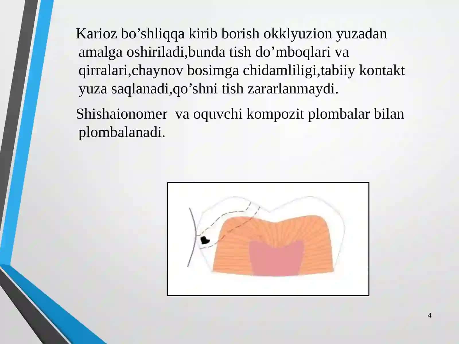 Tunnelli charxlash usuli 4