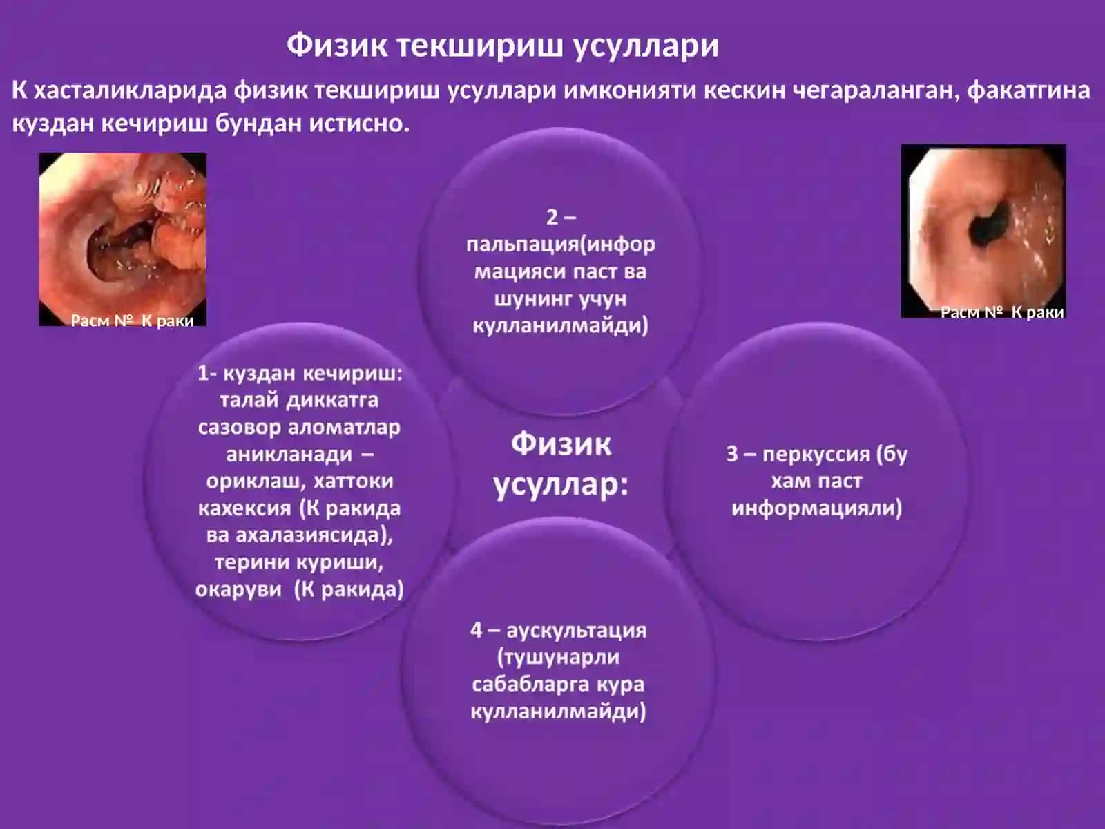 Кизилунгач (К) касалликлари беморларини сураб-суриштириш 4