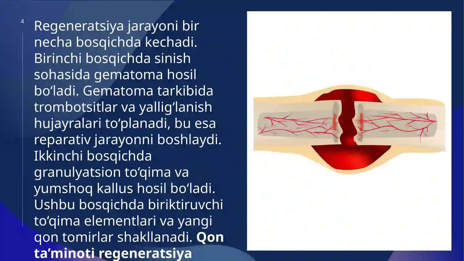 Suyakto‘qimasining regeneratsiyasinistimulyatsiya qilish 4