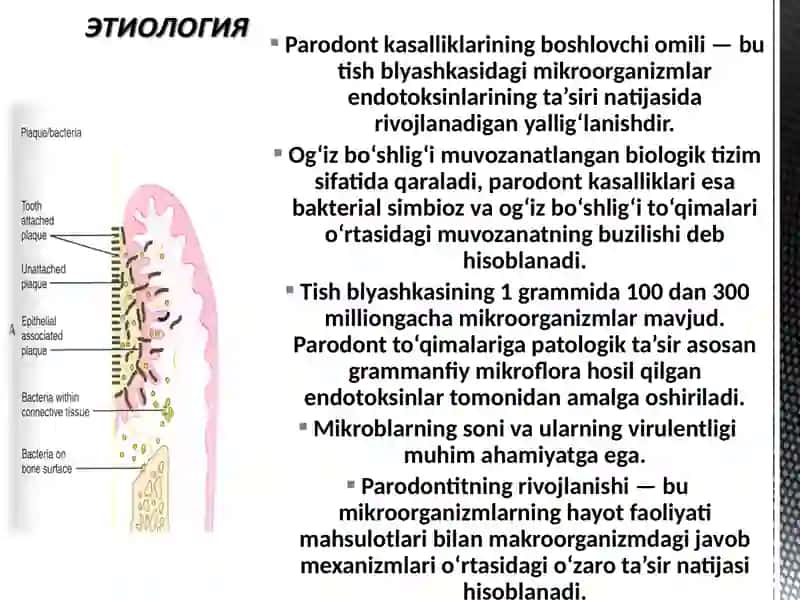 Parodontitlar . Yengil shakli va Gingivit qiyosiy tashxisi 4