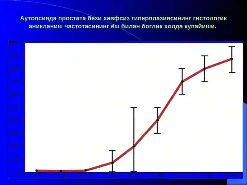 Простата бези хавфсиз гиперплазияси 4