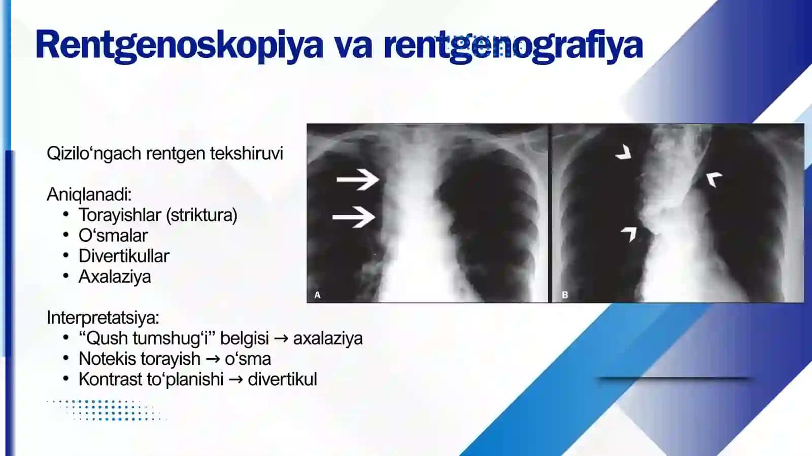Rentgenologik, ezofagogastroduodenoskopik, kolonoskopik, rektoromanoskopik usullarni interpretatsiyasi 4
