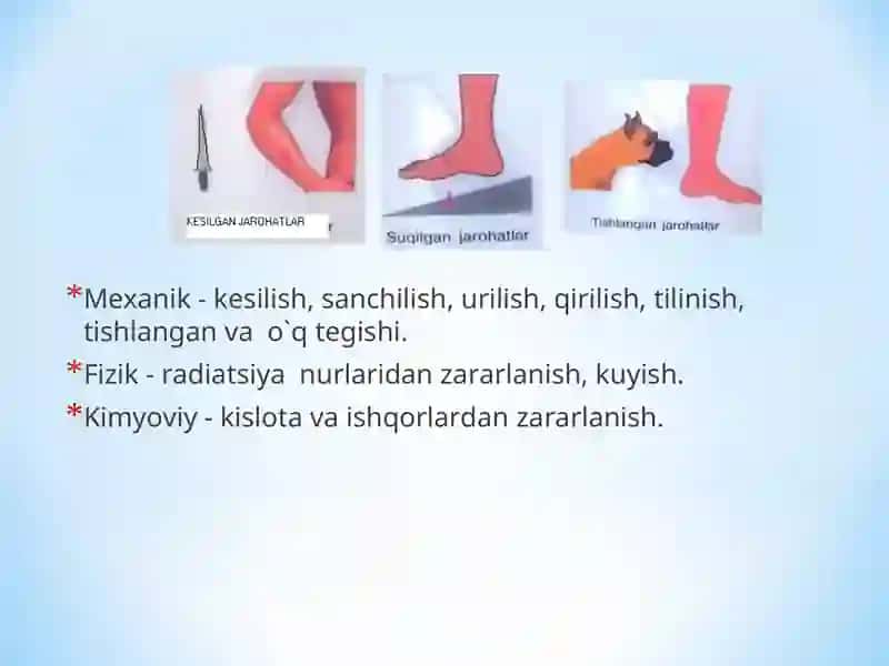 REANIMATSIYA VA OZIQSIZLANTIRISH QON KETISHI TURLARI TIBBIY YORDAM 4