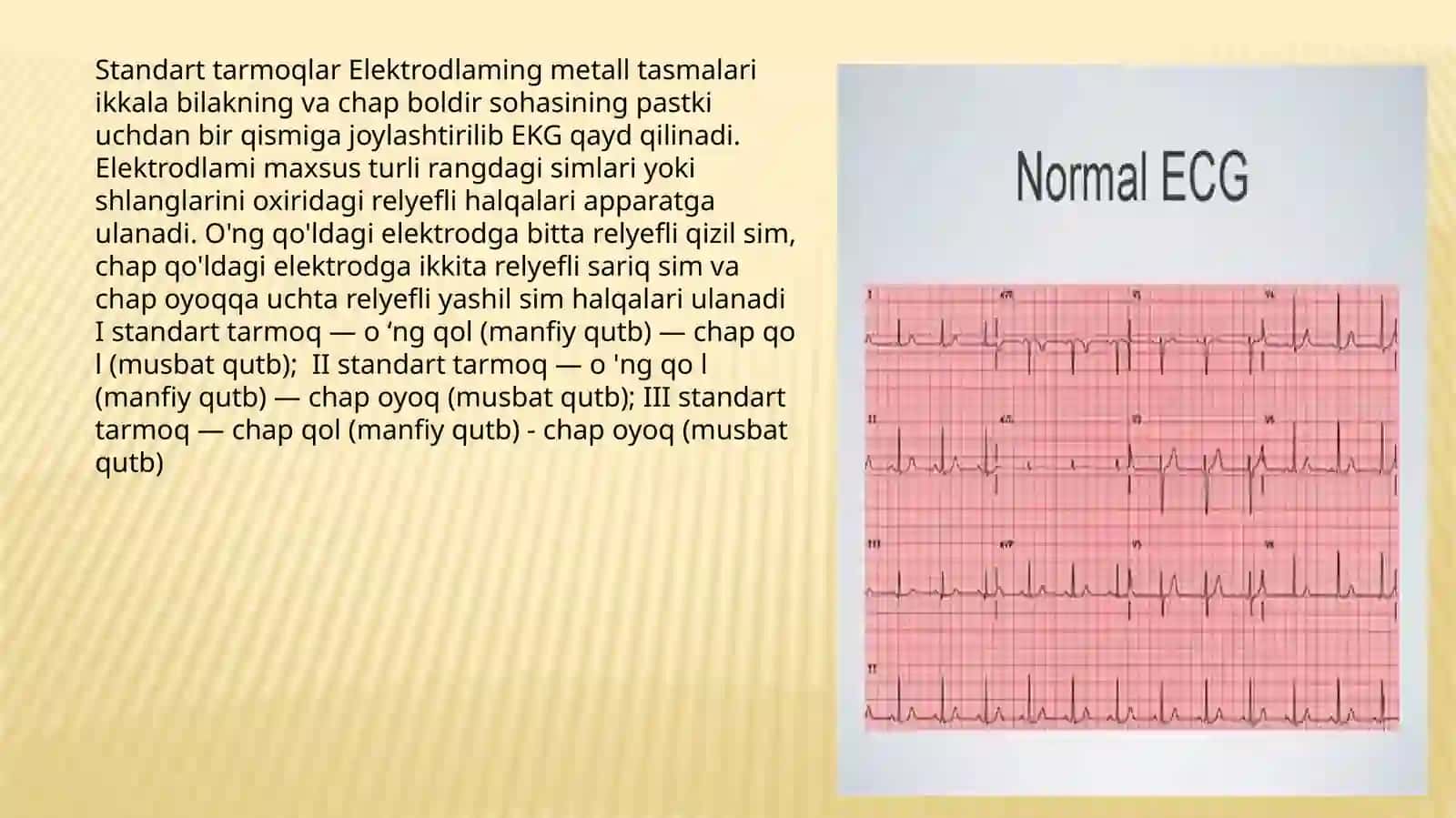 NORMAL EKG.EKGdagi tarmoqlar.Tishchalar segmentlar intervallar.Elektrokardiogramma.EKGni yozib olishtartibi 4