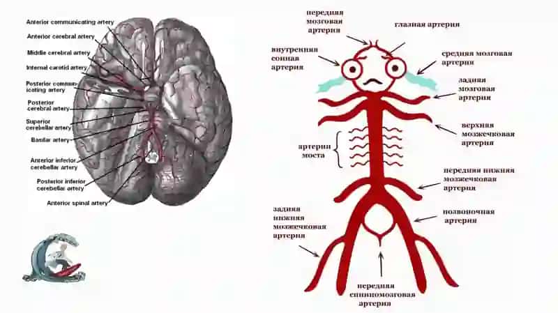 Og'ir ipsilateral yoki ikki tomonlama uyqu arteriyasi stenozi 4