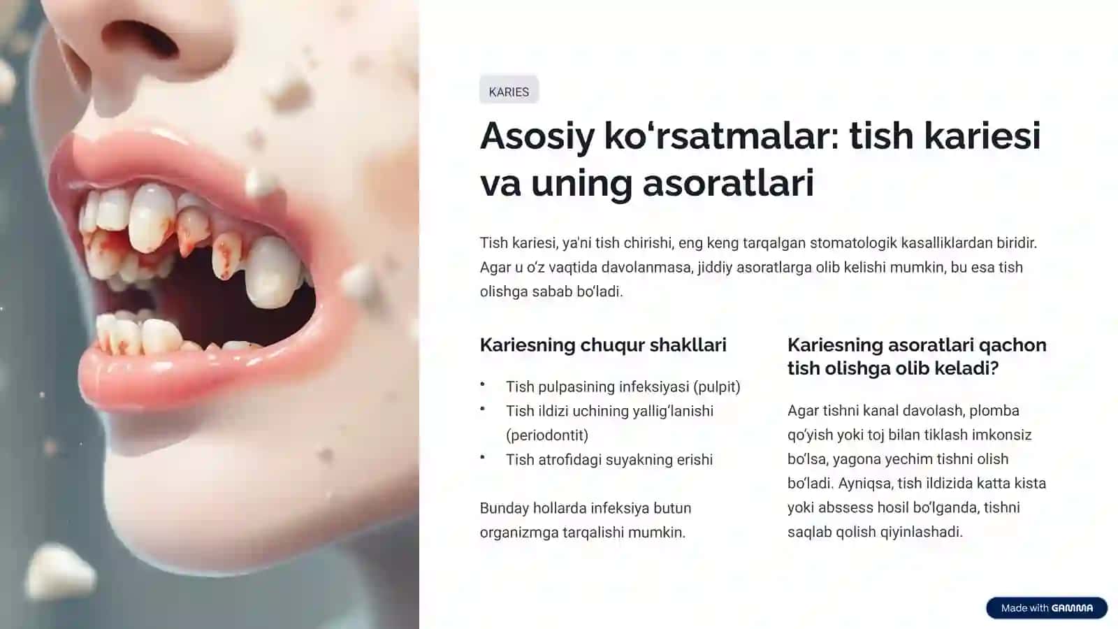 Tish olish operatsiyalari: Ko‘rsatmalar, qarshi ko‘rsatmalar, asoratlari 4