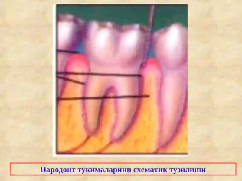 Пародонт касалликлари этиологияси ва патогенези 4