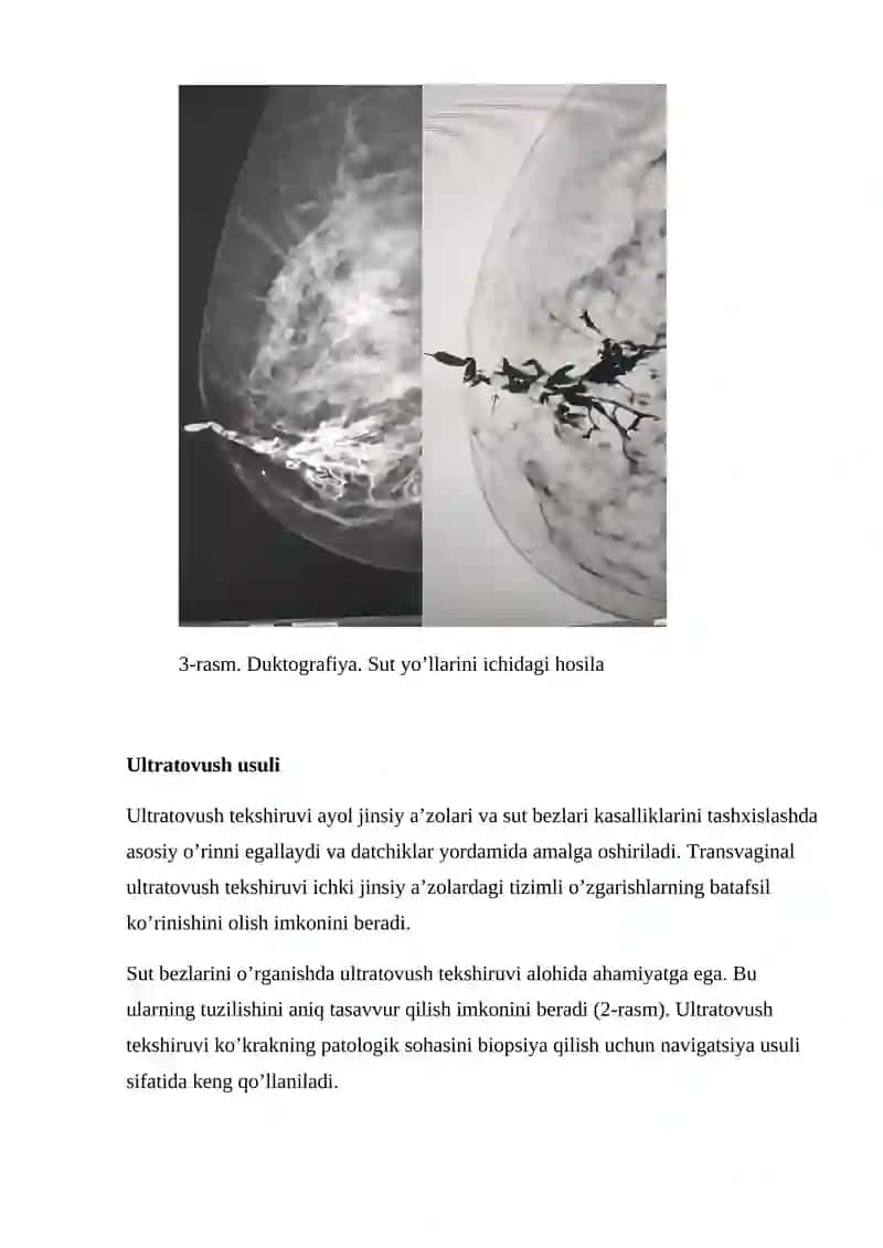 Ayol reproduktiv tizimining nur tashxisi usullari 4