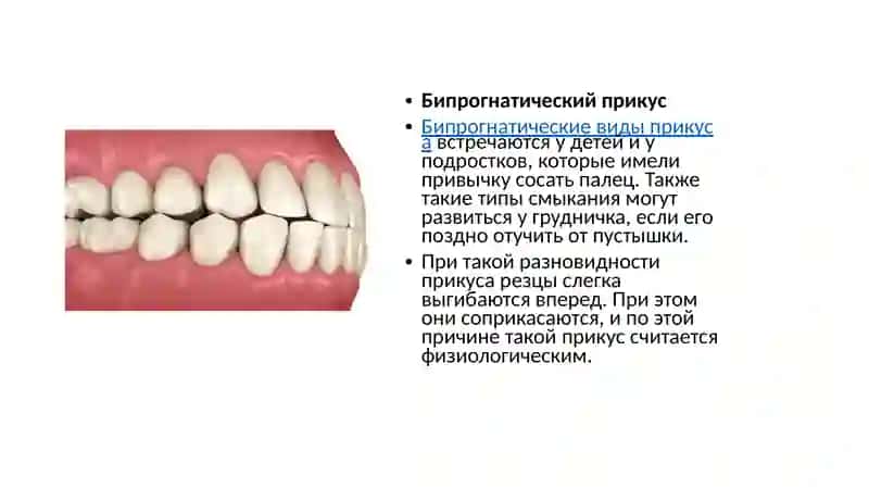 Ортогнатический прикус 4