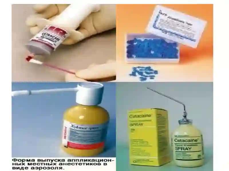 Terapevtik stomatologiya ishlatiladigan anesteziya turlari 4
