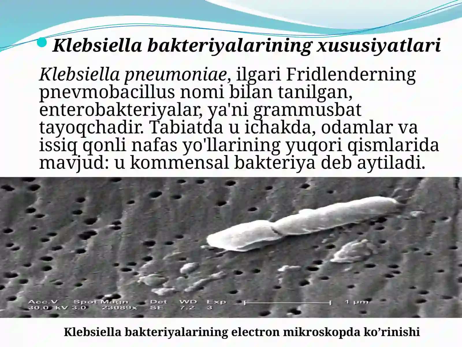Shartli patogen dioreogen ichak gruppa bakteriyalari: Sitobakter, Klebsiella, Enterobakter vа ularning amaliyotdagi ahamiyati. Ularkeltirib chiqaradigan kasalliklar, laborator tashxisi 4