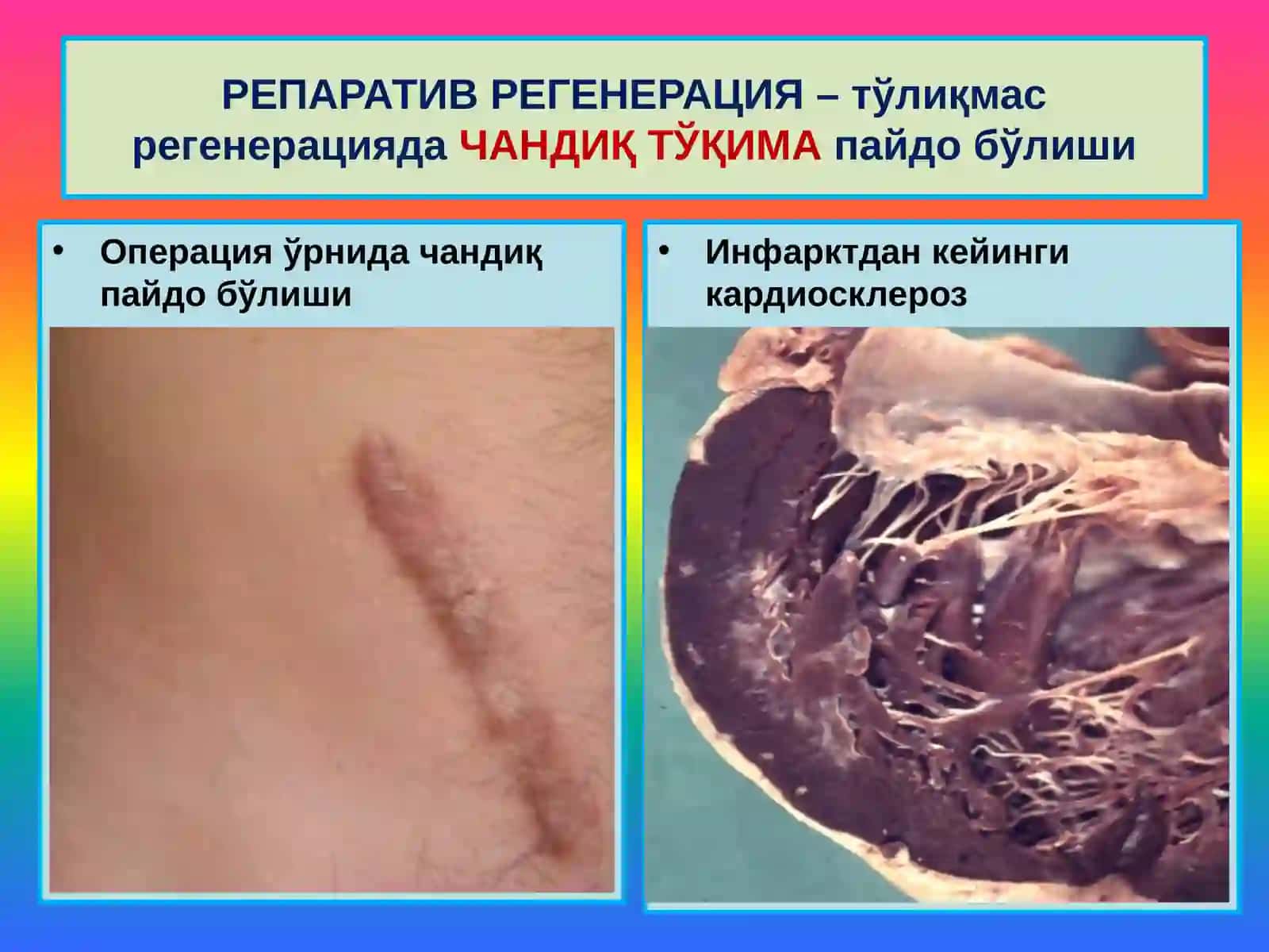 МОСЛАНИШ-ЎРИН АЛМАШИНИШ ЖАРАЁНЛАРИ 4