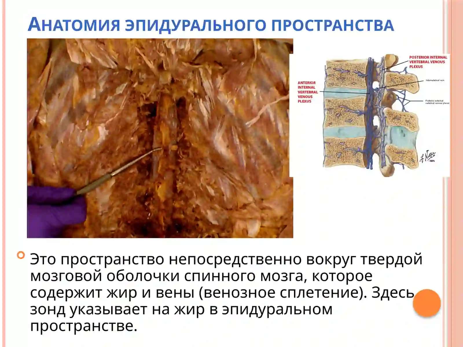 Ультразвуковая визуализация позвоночника 4