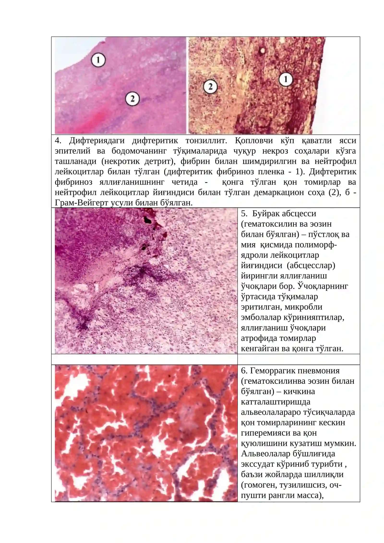 Яллиғланиш ва репарация 4