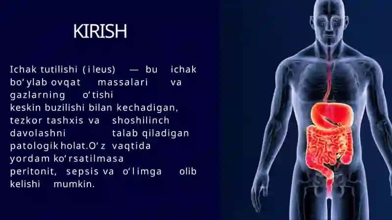 Ichak tutilishi taqdimot 4