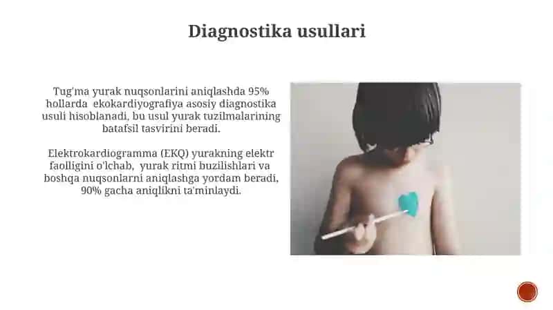 Yurak tug'ma nuqsonlari 4