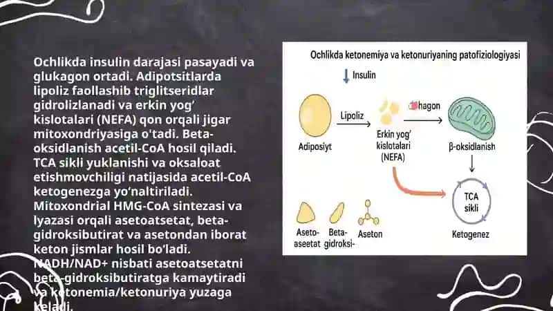 Qaпdli diabet vа ochlikda kеtоnuriуа vа kеtоnemiуа 4
