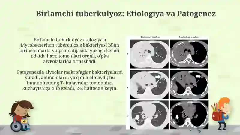 Tuberkulyozning klinik tasnifi 4