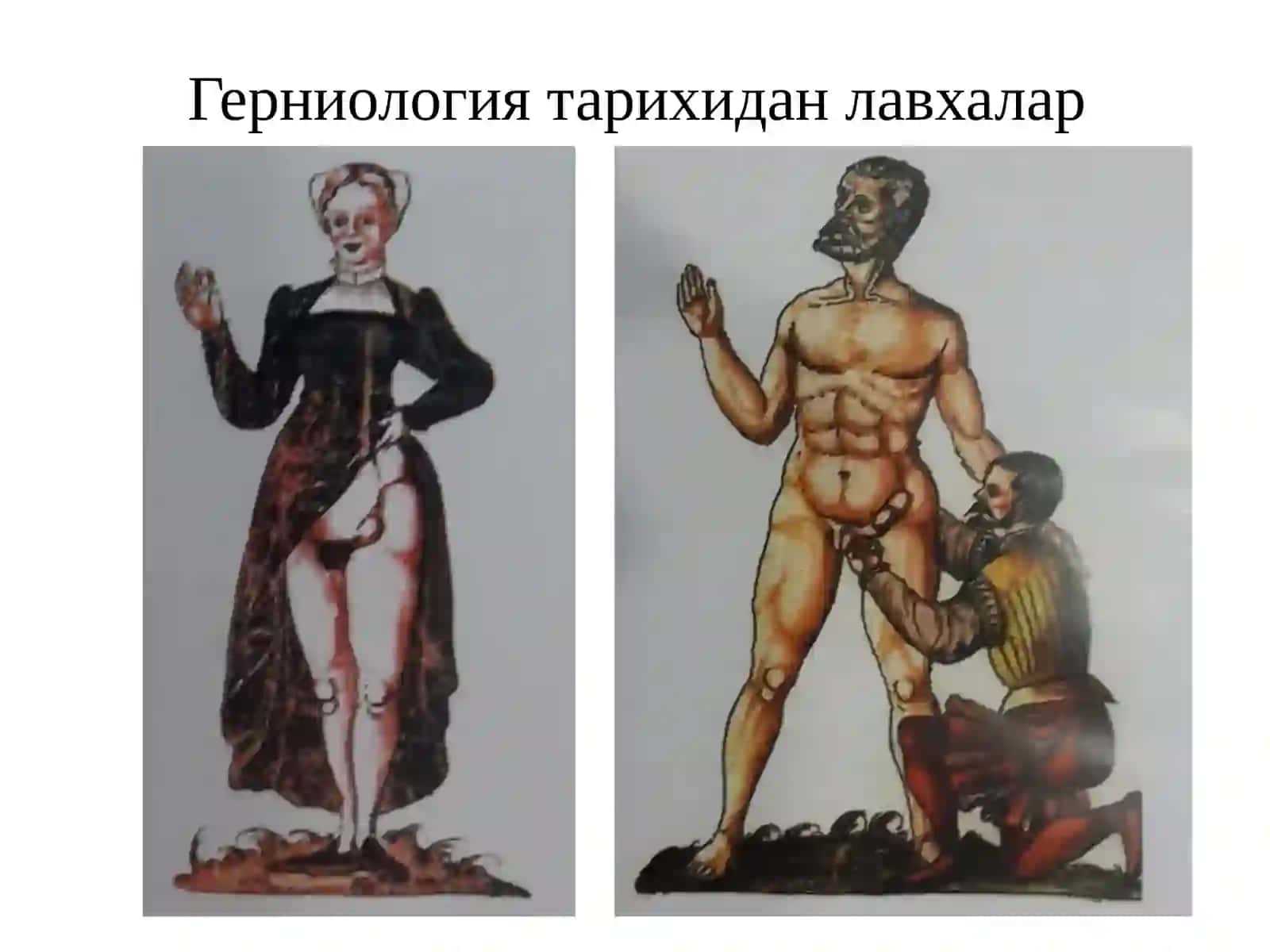 Қорин чурралари ва унинг асоратлари 4