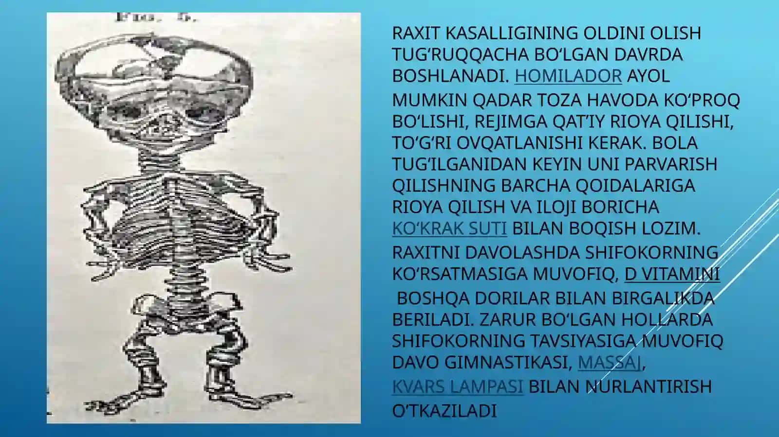 Raxit kasalligi 4