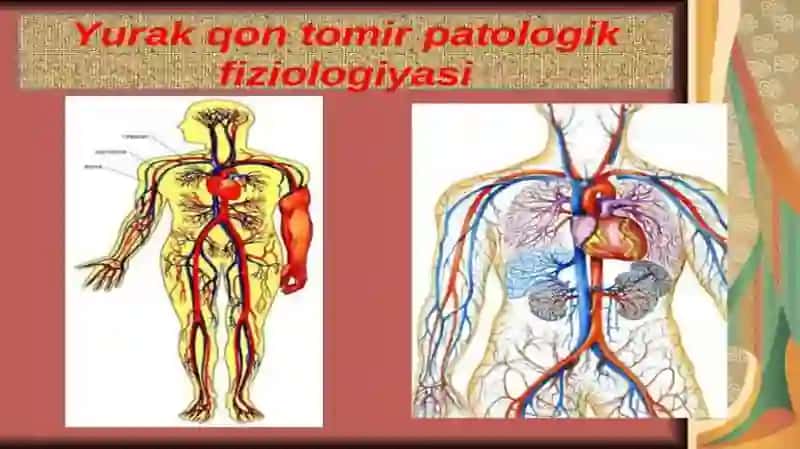 vena limfa tomirlari patalogiyasi tomirlarga aralashishdagi patalogiya intervensi 4