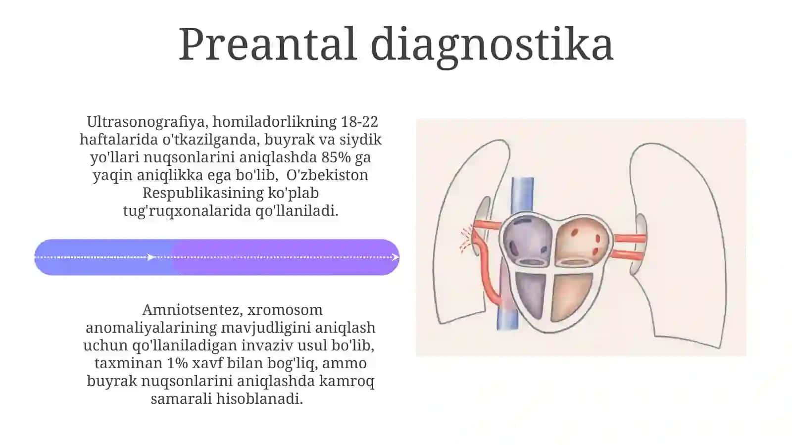 Buyrak va siydik yo'llari tug'ma nuqsonlari 4