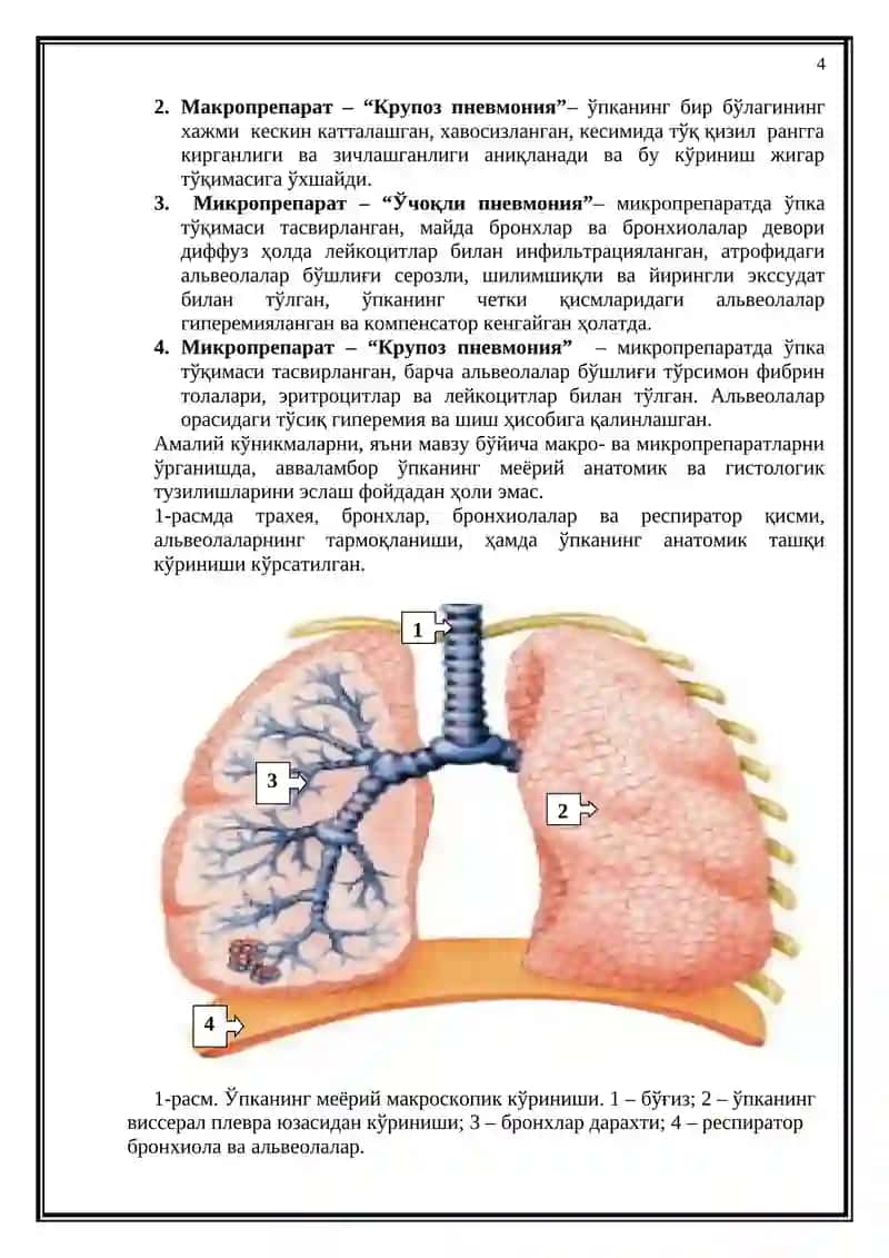 ЎПКА КАСАЛЛИКЛАРИДА ОҒИЗ БЎШЛИҒИДАГИ ЎЗГАРИШЛАР. Ўткир пневмониялар: ўчоқли пневмония, крупоз пневмония 4