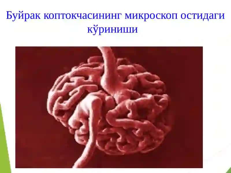 Туғманефритлар.Гломерулонефрит 4