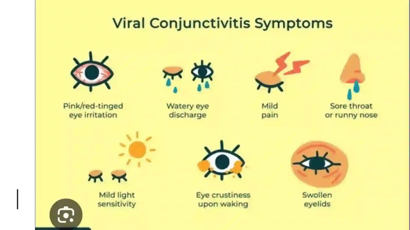 Virusli konyuktivitlar 4