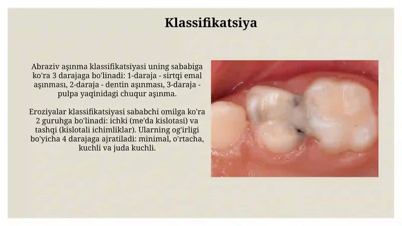 Tish chiqqandan keyin paydo boladigan nokaries kasalliklar. Mexanik travma 4