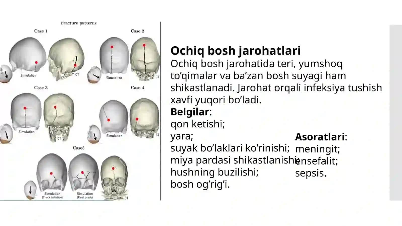 Boshning ochiq jarohatlari va yopiq shikastlari | Tibbiy PowerPoint (PPT) taqdimoti | Tibbiyot talab 4