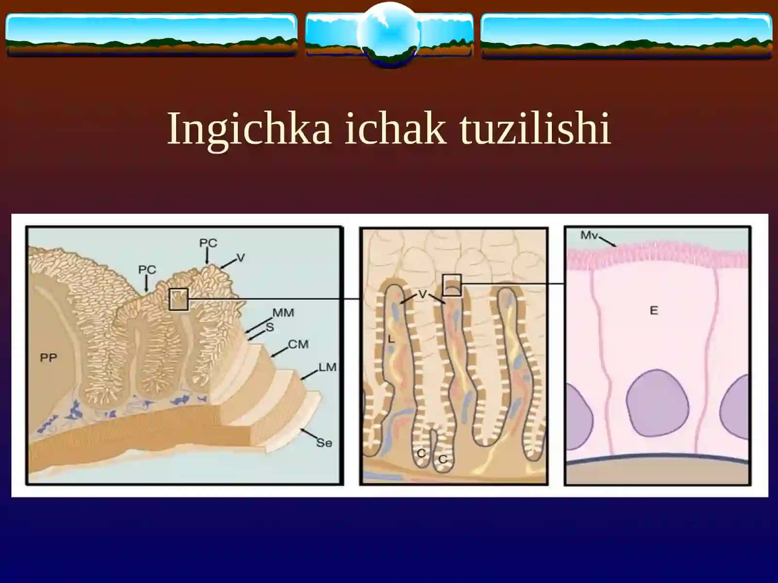 SURUNKALI ENTERIT. SURUNKALI KOLIT 4