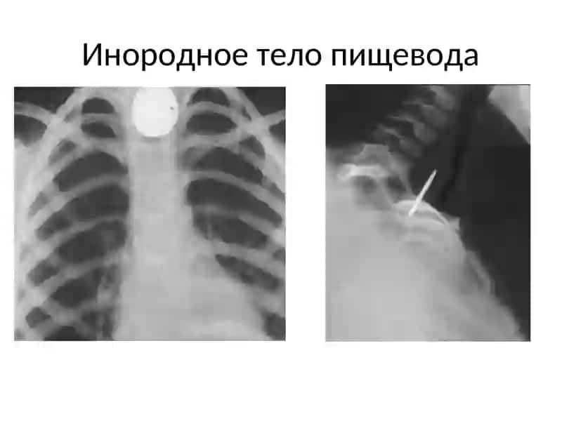 Желудочно-кишечный тракт 4