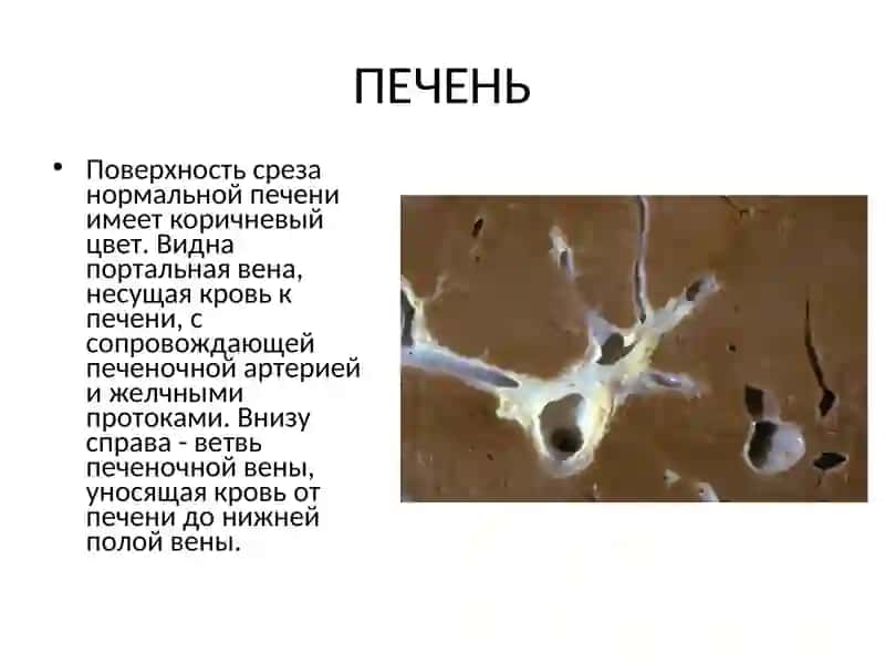 Болезни печени 4