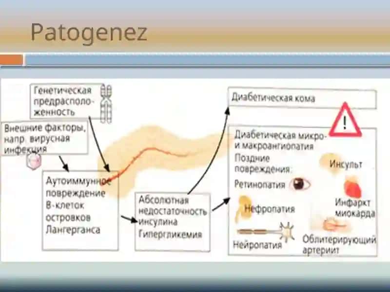 Qandli diabet 4