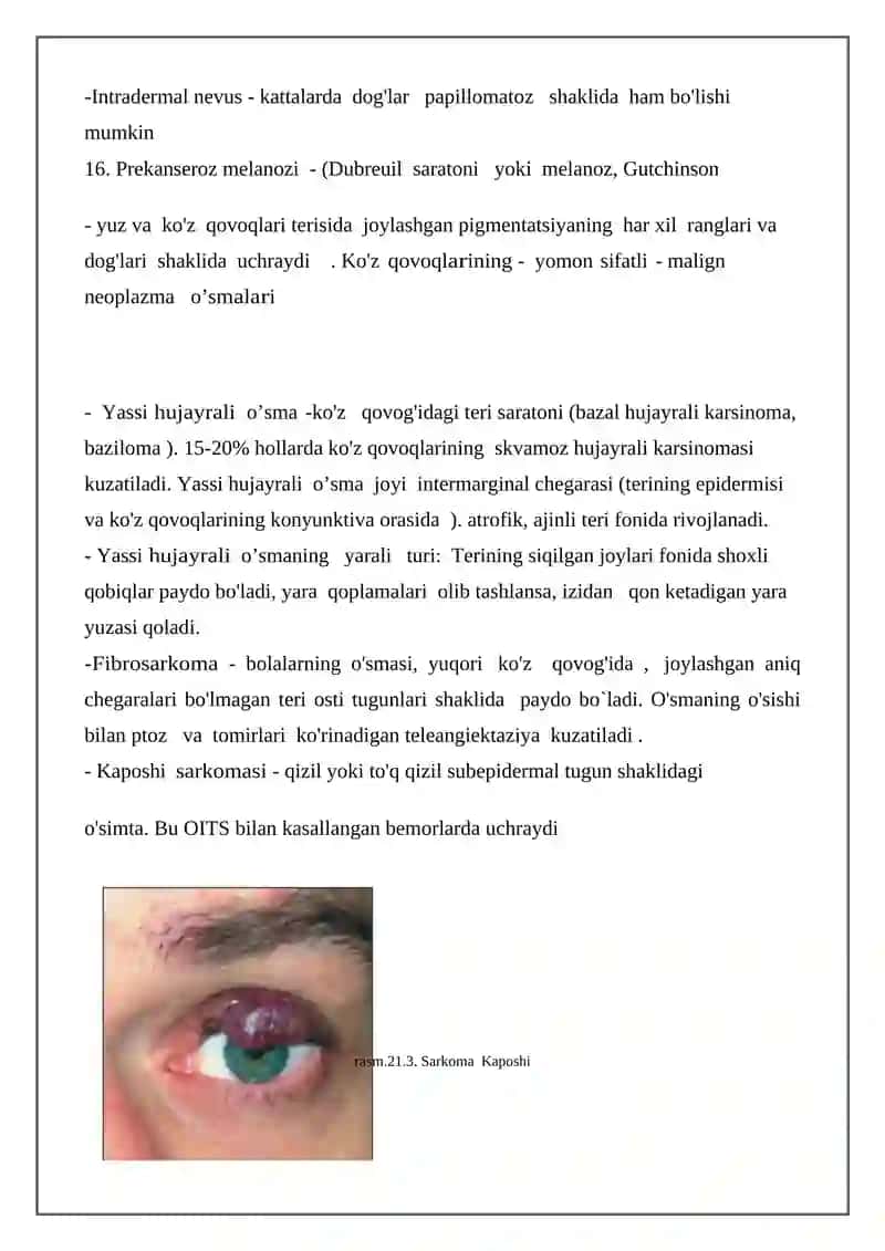 Ko'z qovoqlarining o'smalari 4