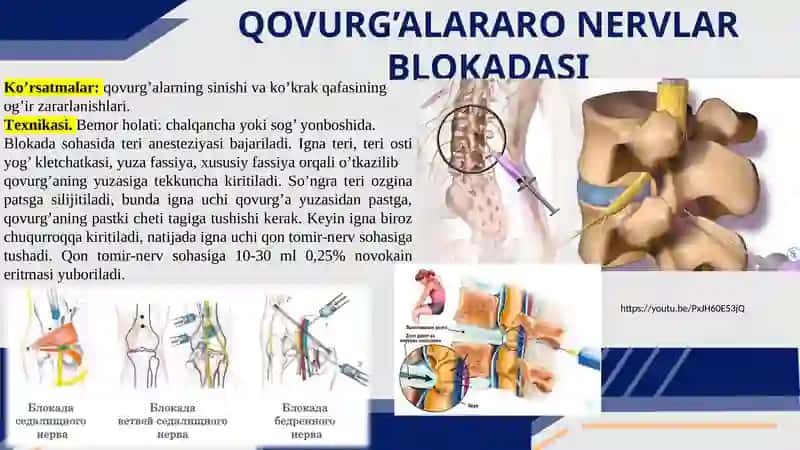 TORAKOTOMIYALAR. QOVURG`ALARARO BLOKADA TEXNIKASI 4