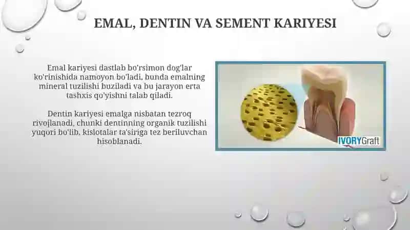 Kariesning ta'rifi va tasnifi 4