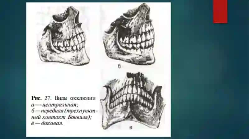 Markaziy jipslashuv. Okklyuzion egrilik. Norma va patologiyadagi okklyuziya. Okklyuziyani shakllanishi. 4