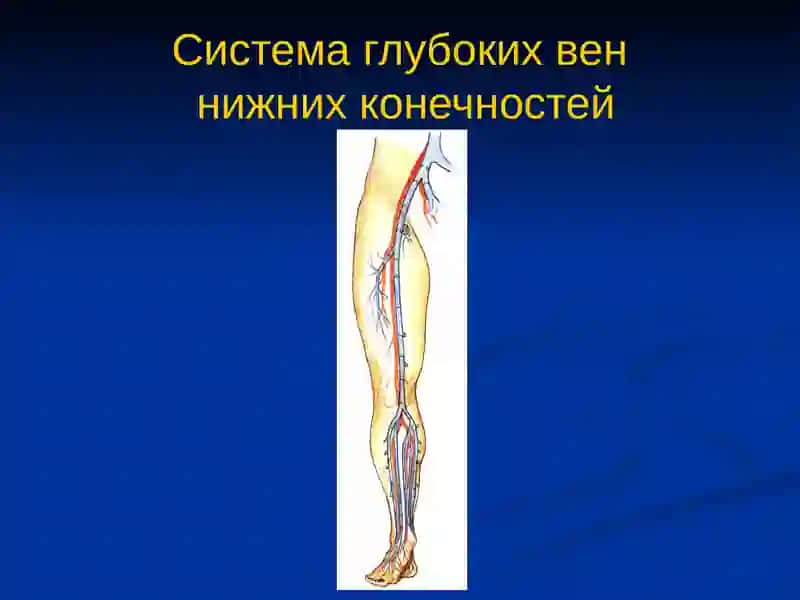 Заболевания вен нижних конечностей 4