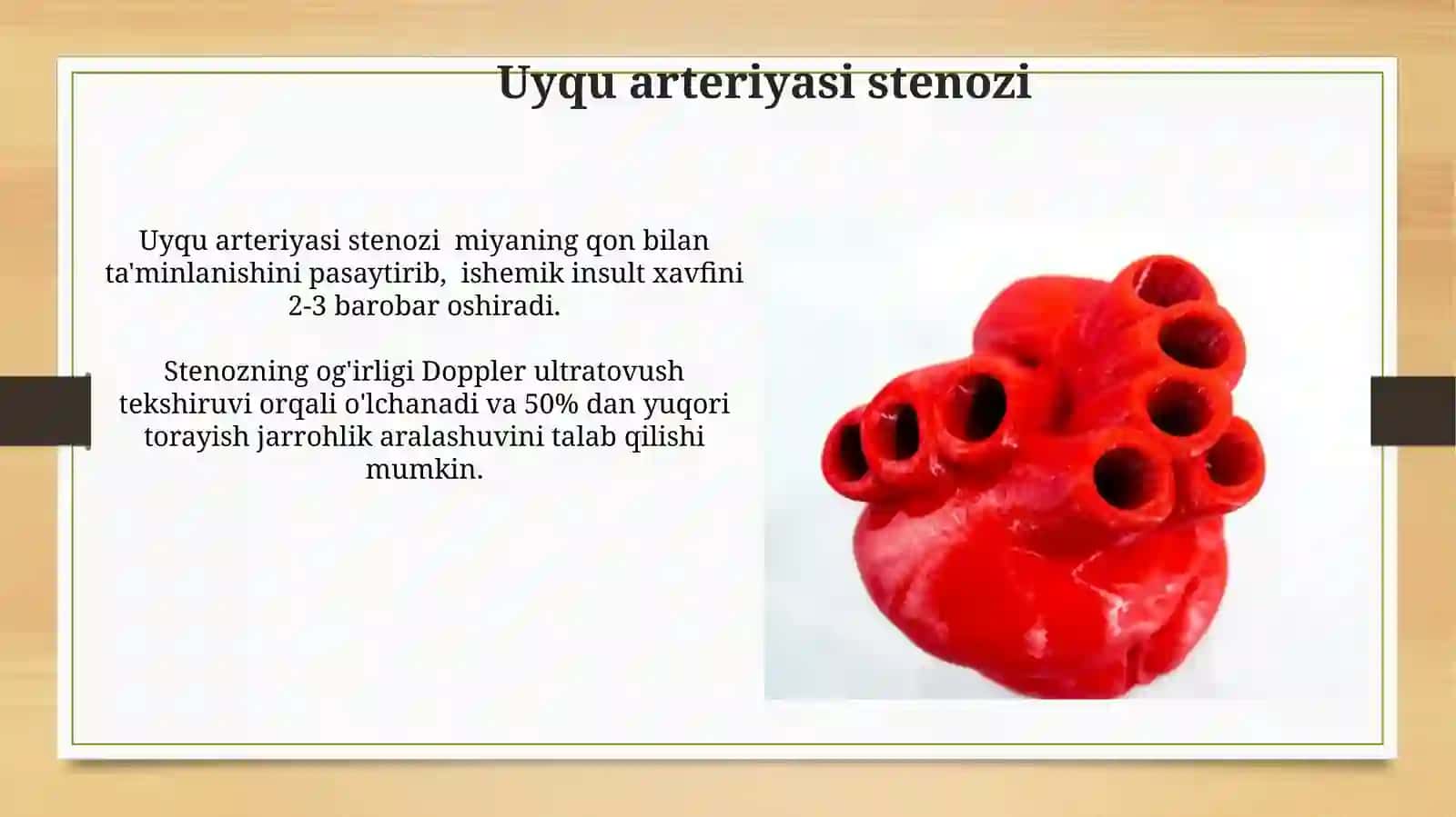 Aorta va uning yoyining anatomiyasi 4