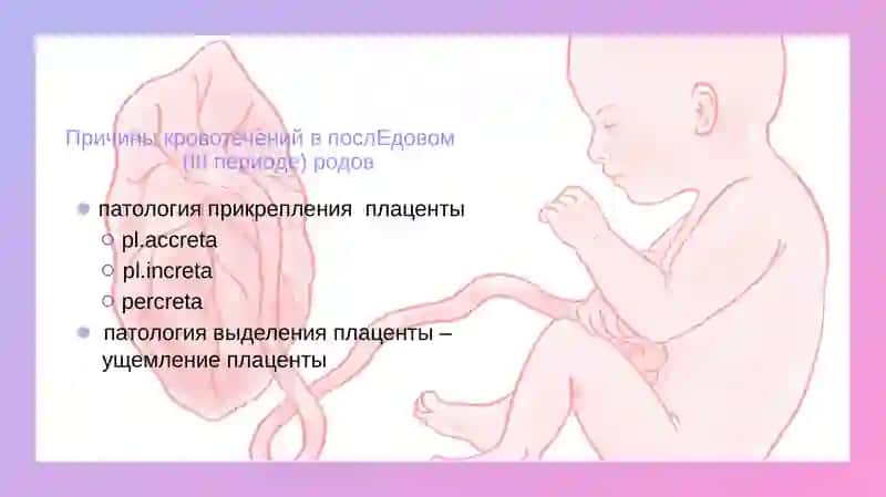 Инновационные методы лечения и профилактики акушерских кровотечений 4