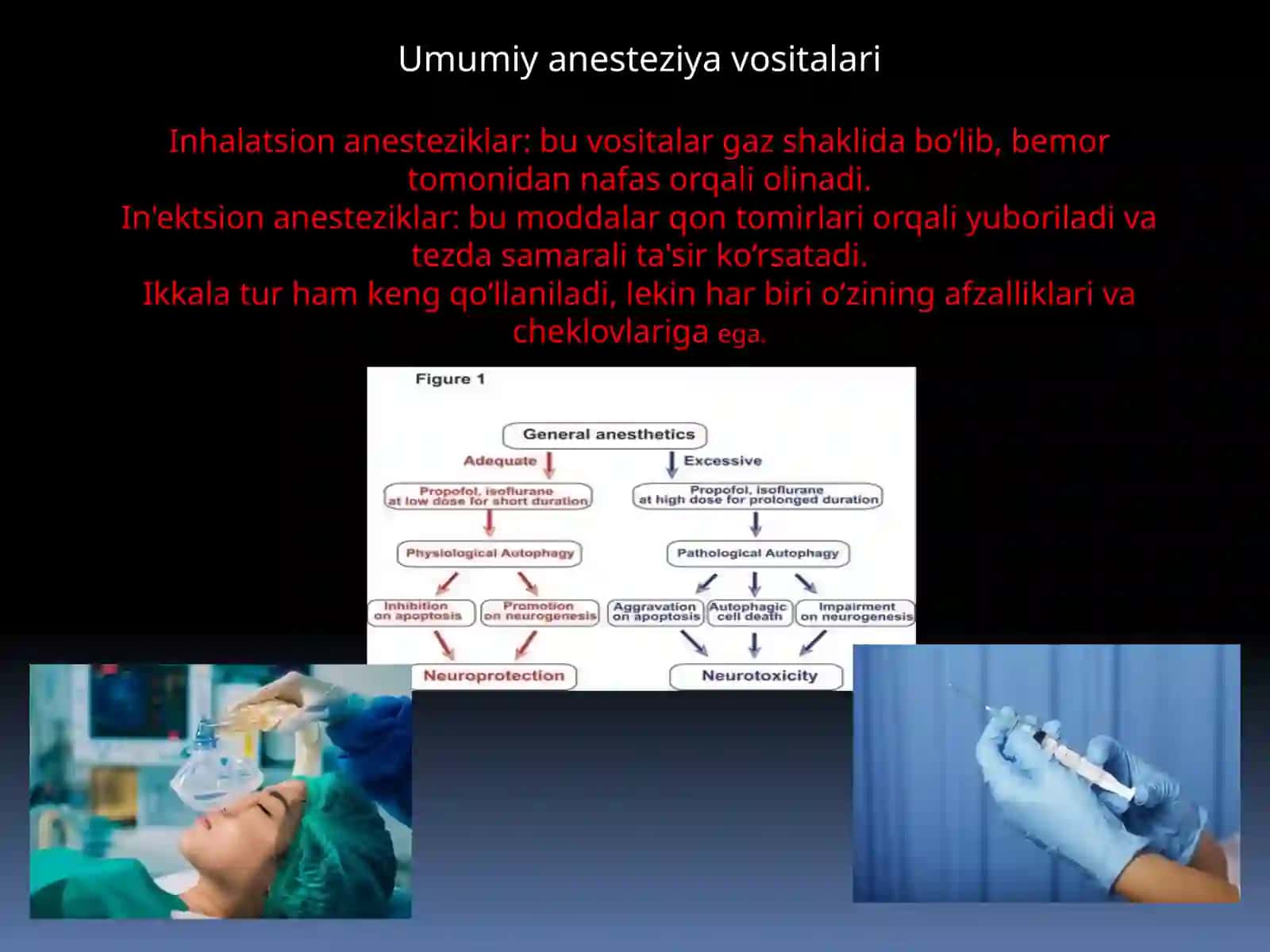 Zamonaviy anestetik vositalar 4