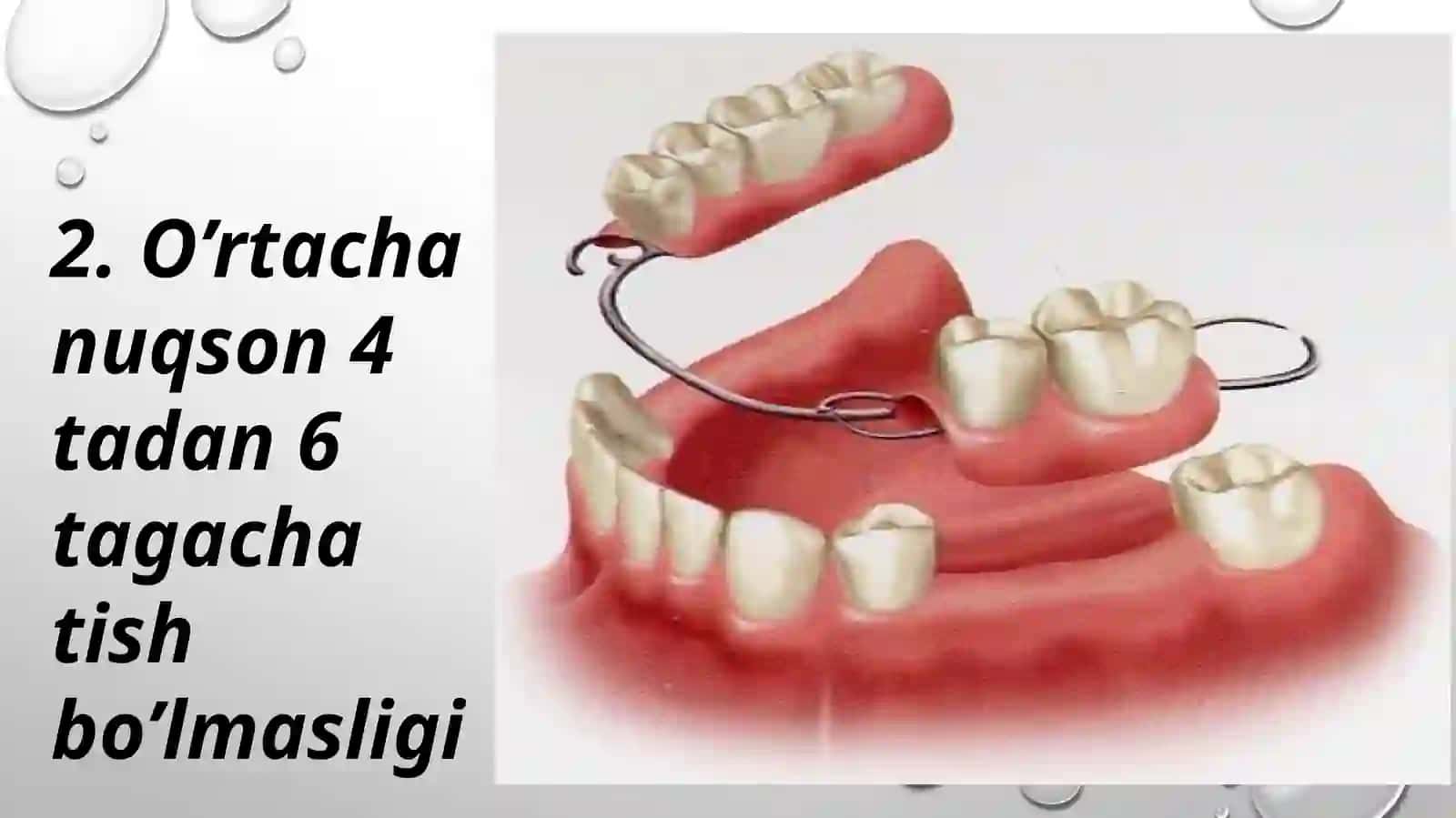 Tish qatorlari qisman nuqsonlari tasnifi. 4