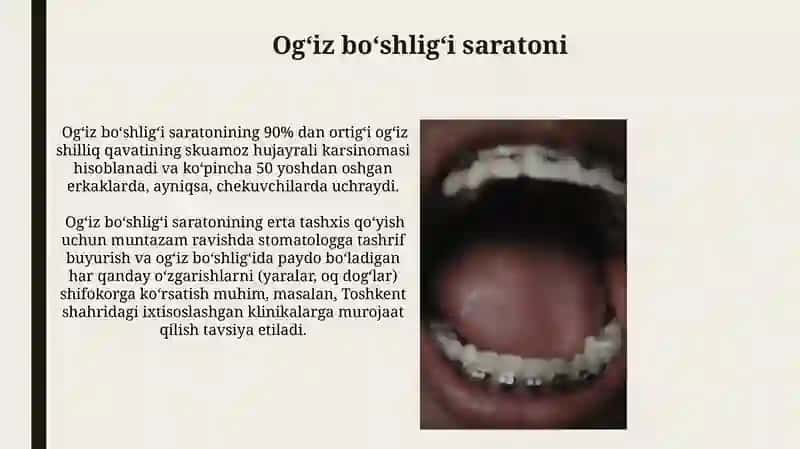Ogʻiz boʻshligʻining tekshiruvi 4