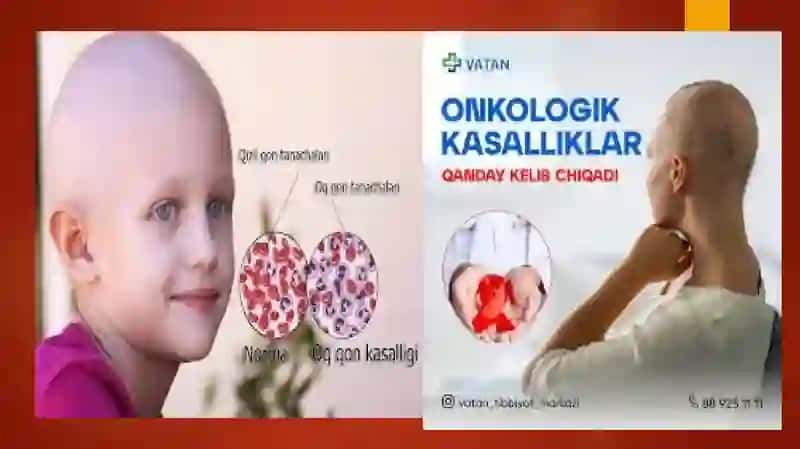 Xastaligi oʻtkazib yuborilgan onkologik bemorlar bilan ishlash deantologiyasi 4